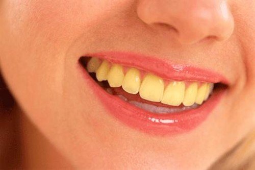 How to Deal with Yellow Teeth?