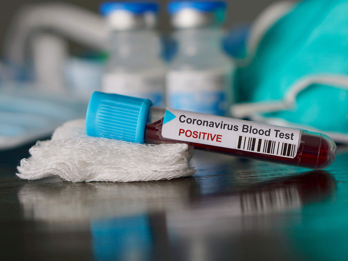 Coronavirus precautions and risk factors: Who should get corona virus Tested ?